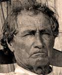 John Lawrence Burns, July 1863, detail