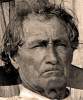John Lawrence Burns, July 1863, detail